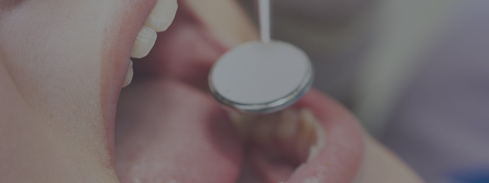closeup of mouth at dentist