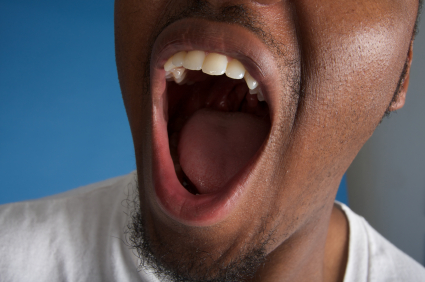 Man opening his mouth wide for dental exam