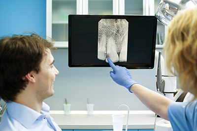 Female Dental Professional and radiologist, explaining X-Ray image to an male patient in Tucson, Arizona
