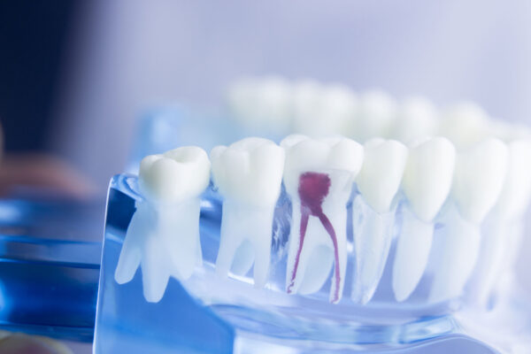 5 Signs That You Might Be Struggling with Gum Disease