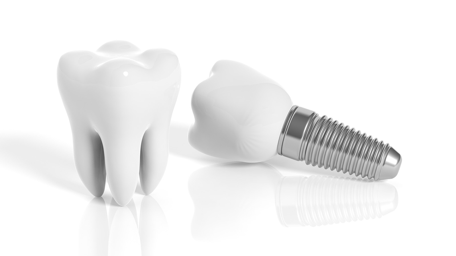 Tooth and dental implants in Tucson Arizona