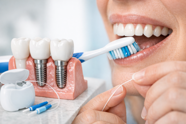 Dental Implant Maintenance: Brushing, Flossing & Long-Term Care